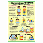 Malnutrition Chart